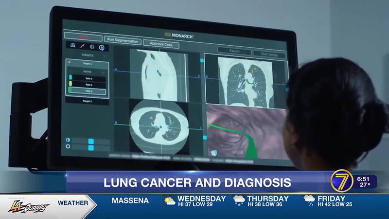 Morning Checkup: Lung Cancer & Diagnosis